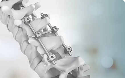 Hiệu suất và ứng dụng của vật liệu hợp kim titan như thanh titan y tế.